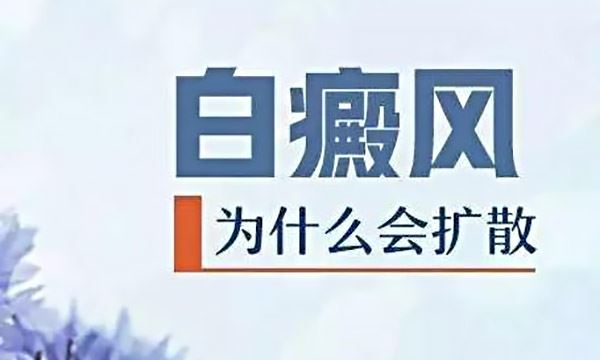 白癜风疾病患者的饮食应该注意什么?